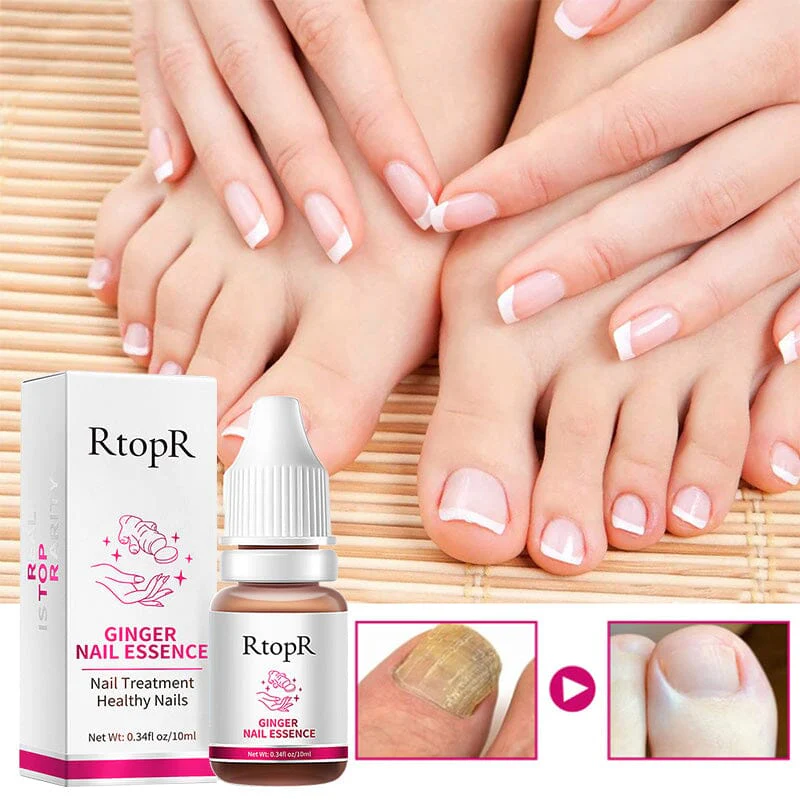 Ginger Nail Essence Repair Fungus Treatment 10ml - Image 11