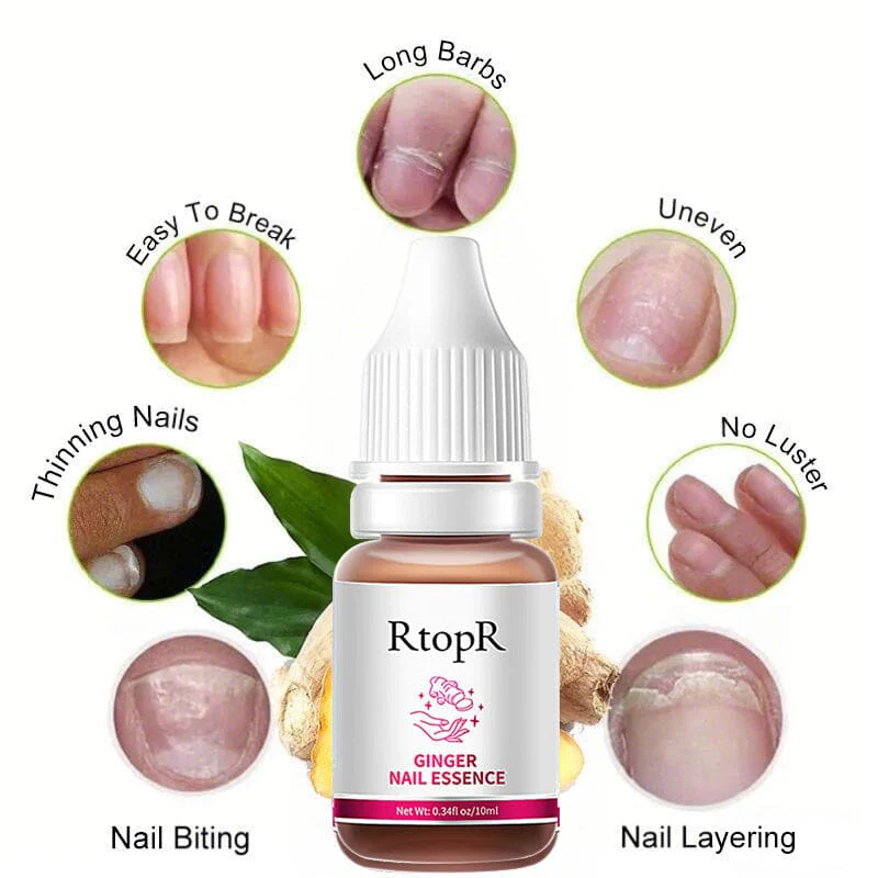 Ginger Nail Essence Repair Fungus Treatment 10ml - Image 4
