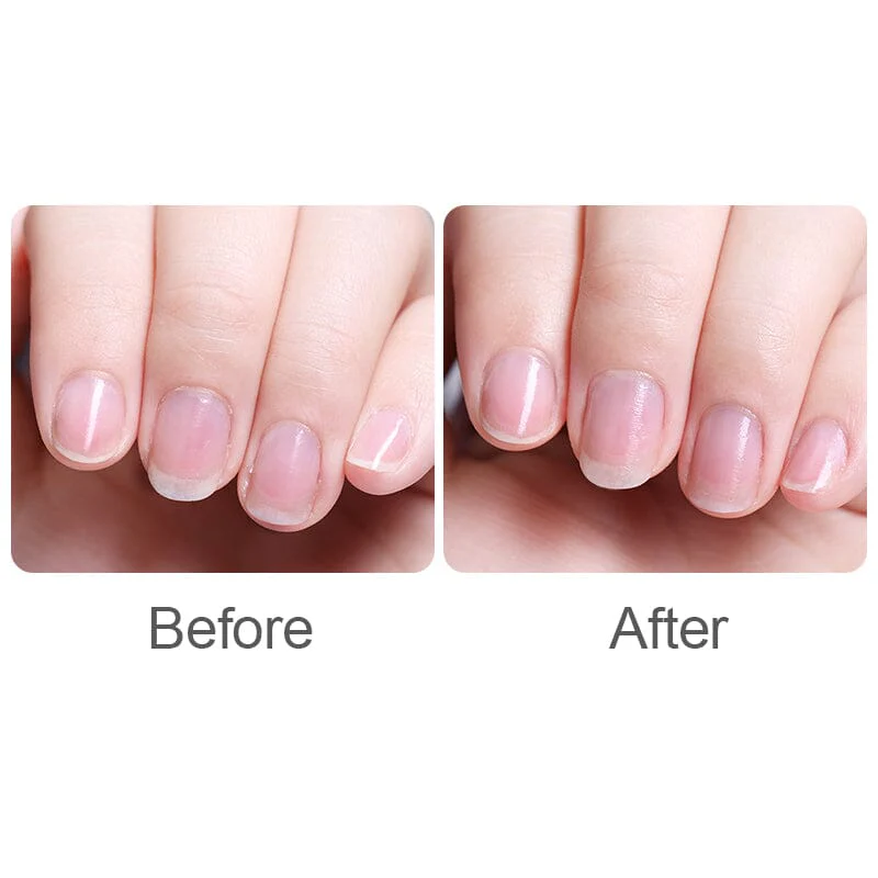 Nail Cutitle Oil 5ml - Image 8